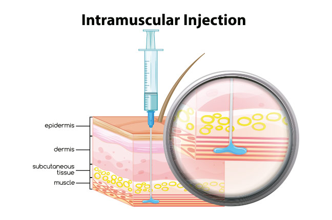 Injeção intramuscular
